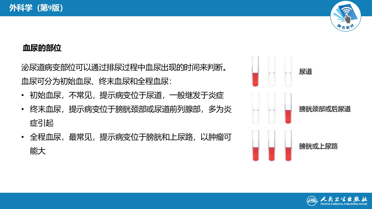 第四十六章 血尿的病因分析