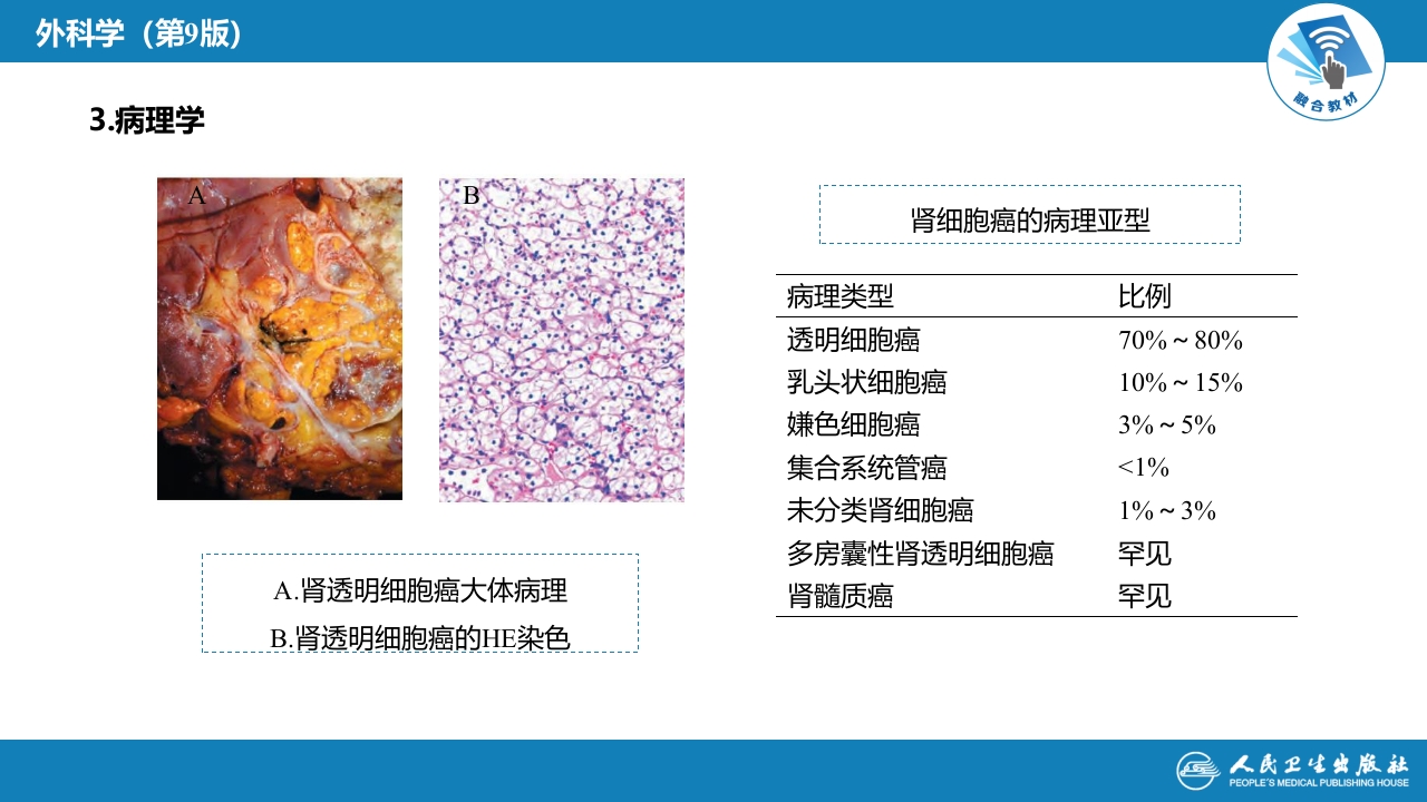 第五十三章 泌尿、男生殖系统肿瘤 第一、二节