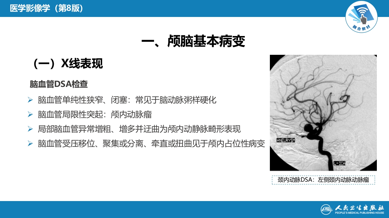 第二章 中枢神经系统 第三节 基本病变表现