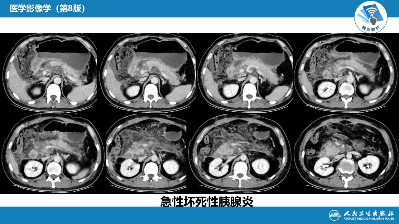 第七章 消化系统与腹膜腔 第二节 胰腺、脾