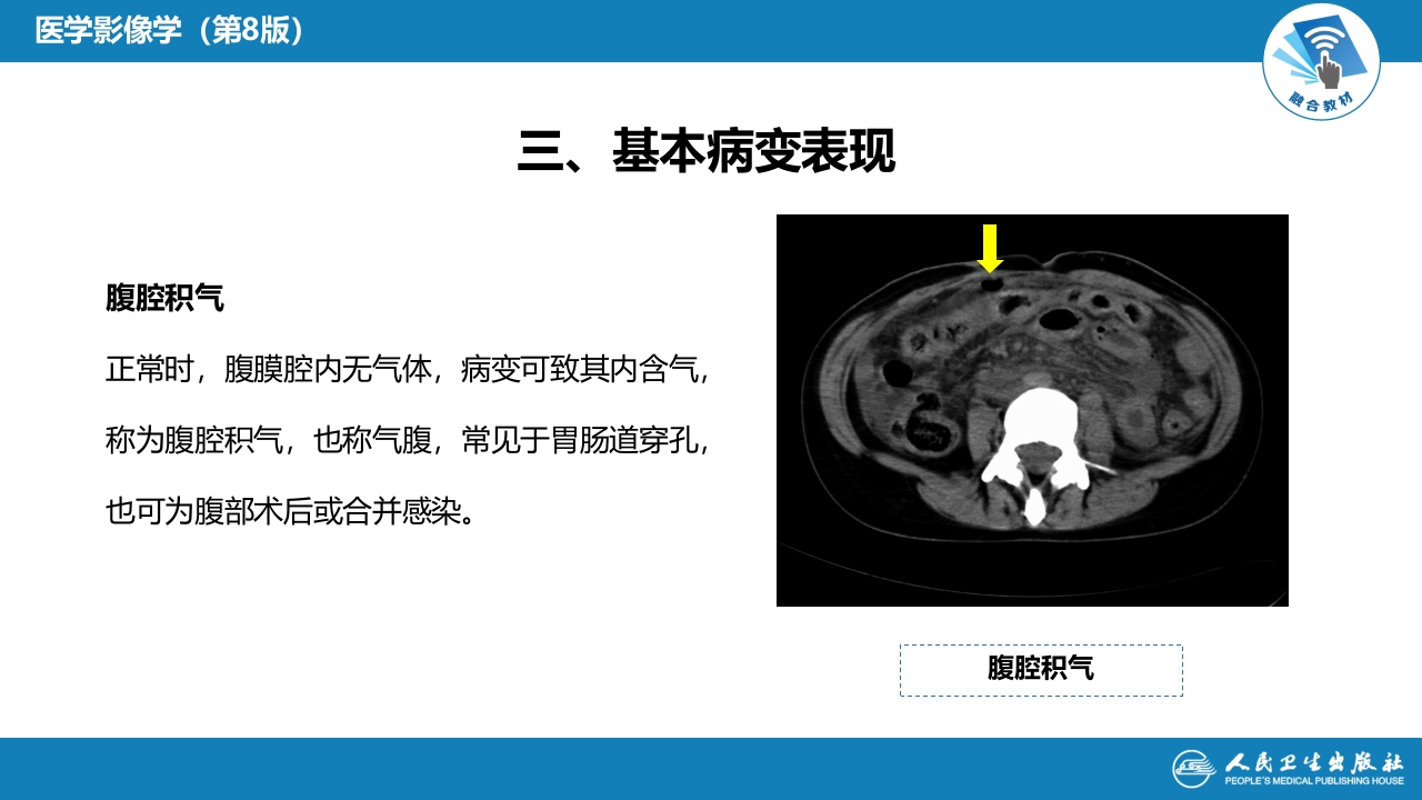 第七章 消化系统与腹膜腔 第三节 腹膜腔和肠系膜