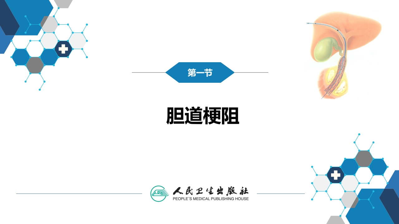 第十四章 非血管疾病介入治疗