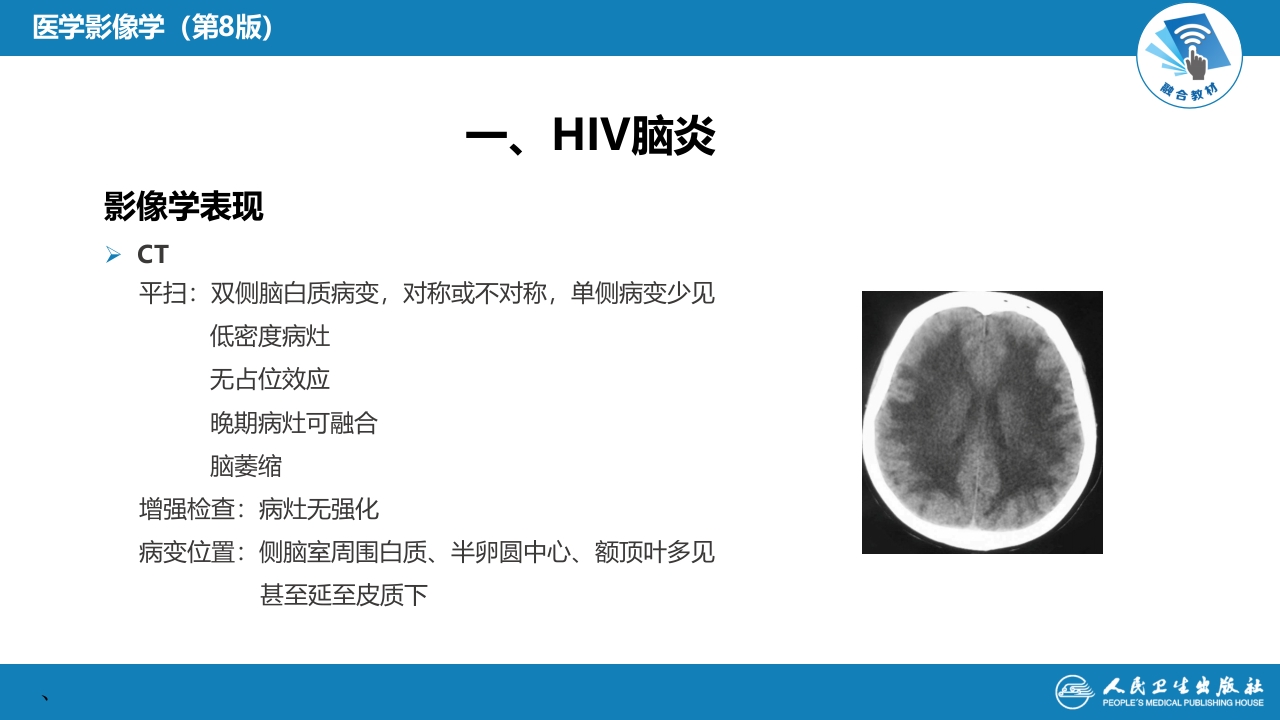 第十一章 传染性疾病