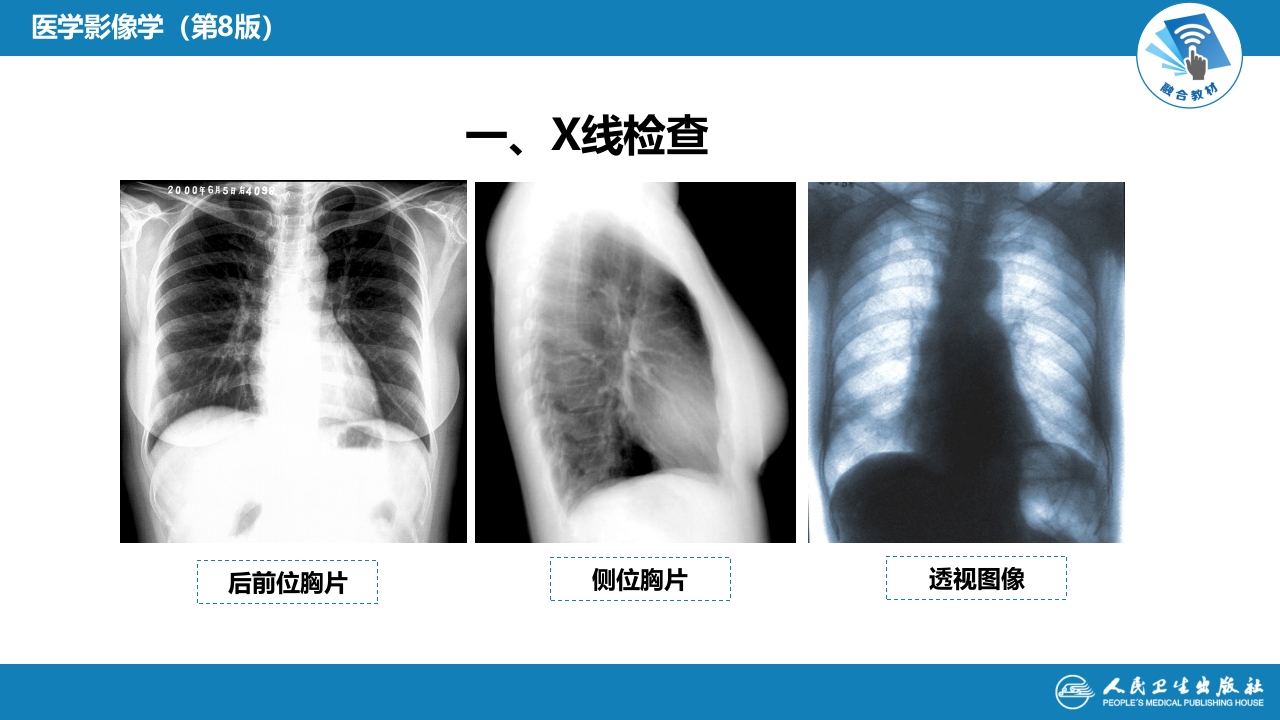 第四章 呼吸系统 第一节 检查技术；第二节 正常影像表现
