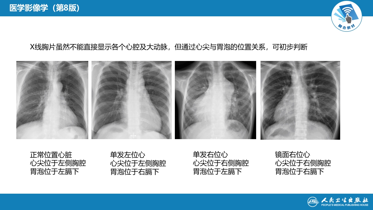 第五章 循环系统 第三节 基本病变表现；第四节 疾病诊断