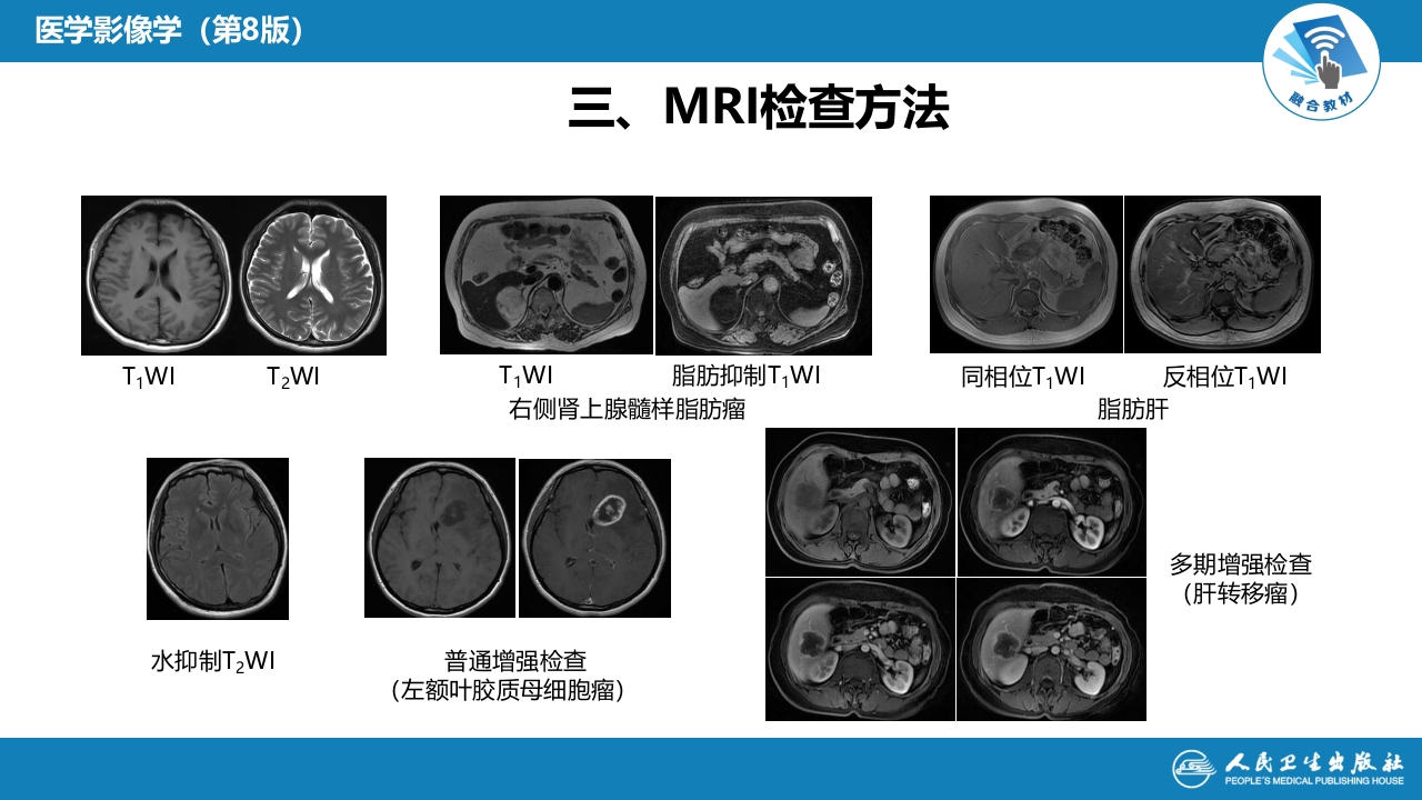 第一章 影像诊断学总论 第四节 磁共振成像