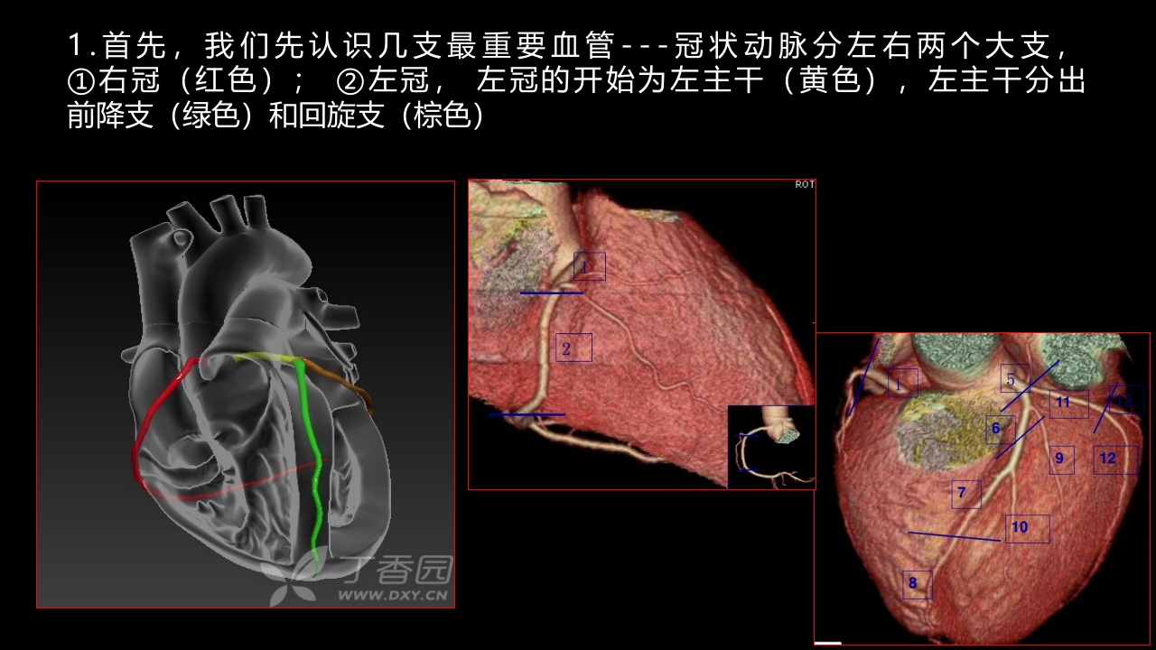多层螺旋CT冠状动脉疾病诊断再学习之一