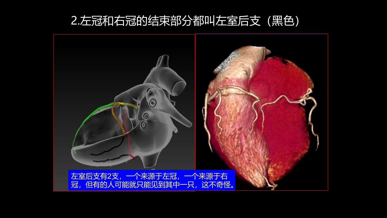 多层螺旋CT冠状动脉疾病诊断再学习之一