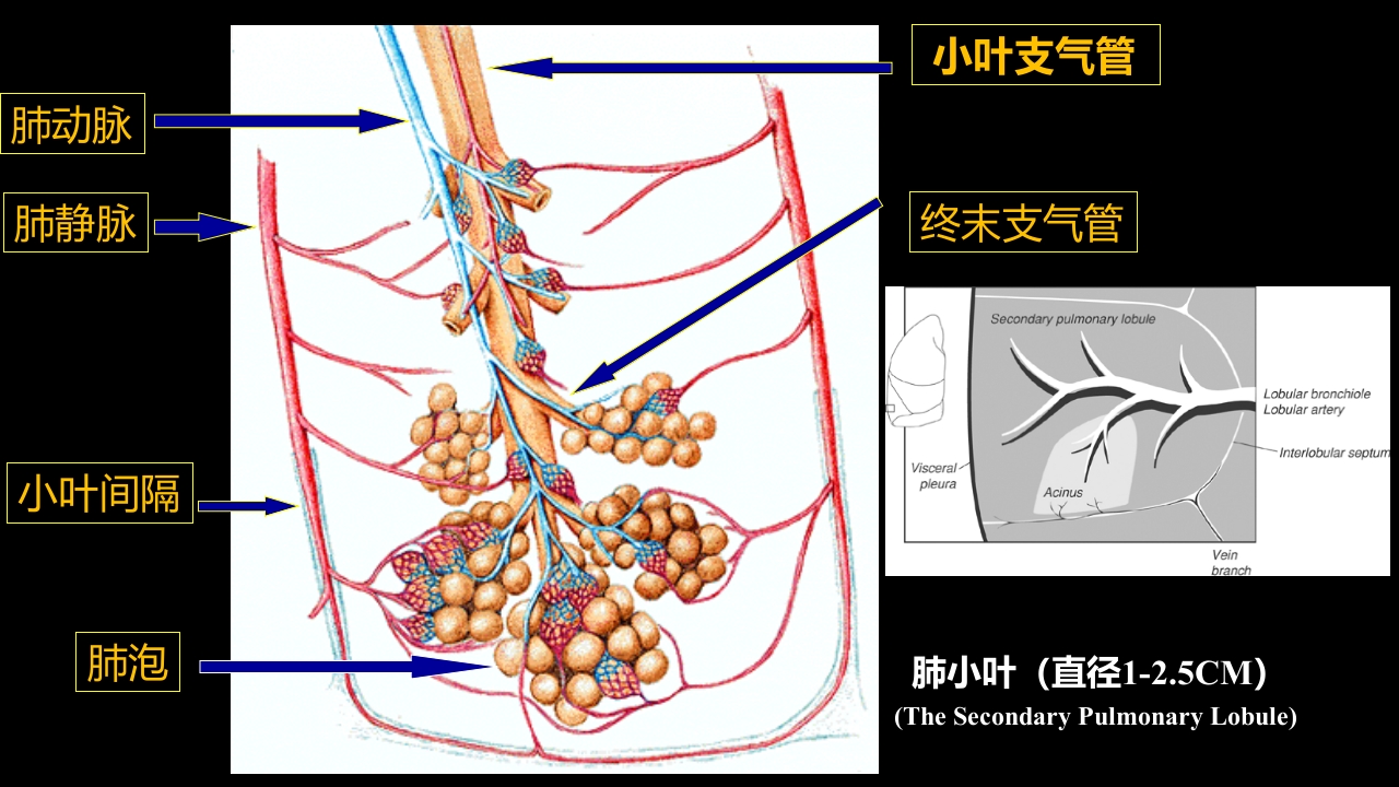 肺部影像学部分病理征象解读