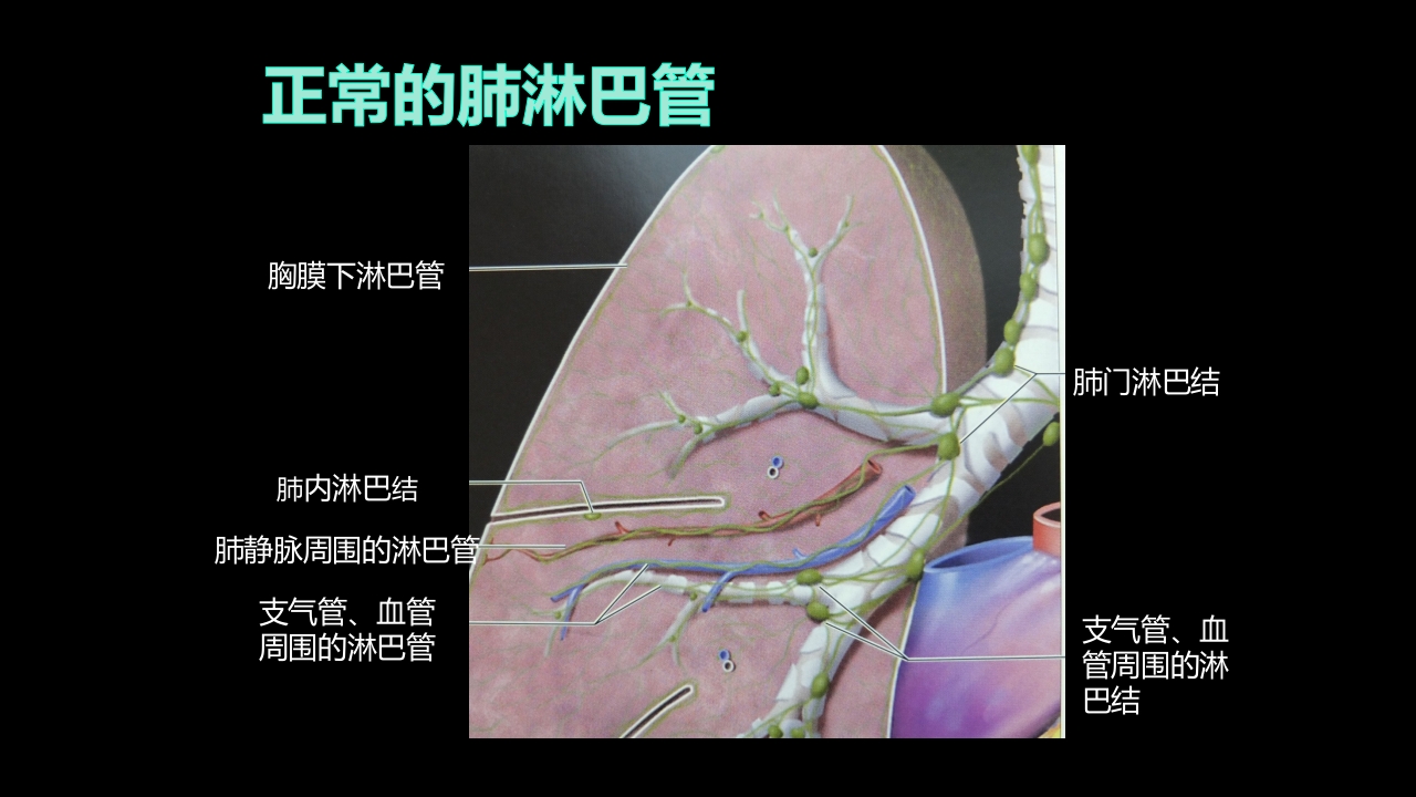 肺部影像学部分病理征象解读