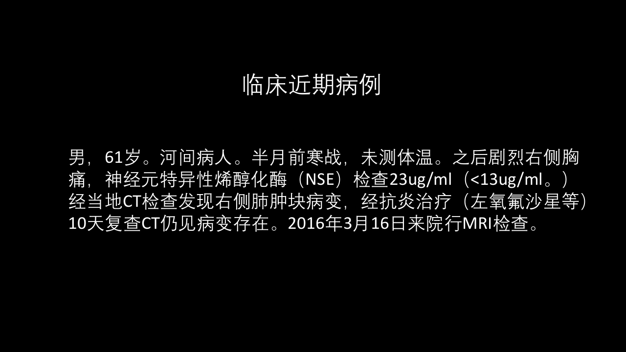 肺部肿块有效的影像检查选择