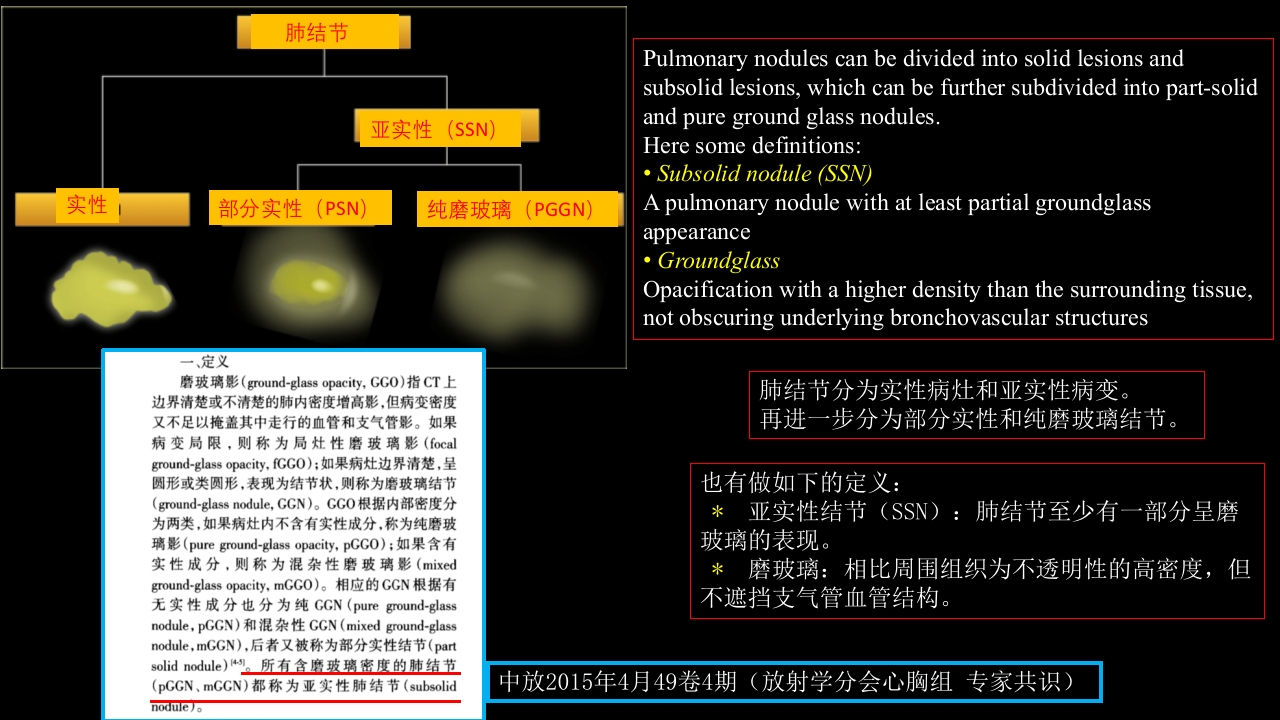 肺结节指南与临床实践