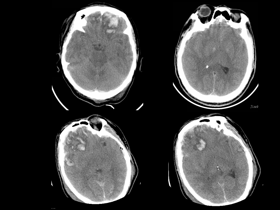 急症影像学诊断