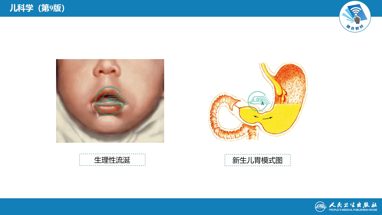 第九章 消化系统疾病