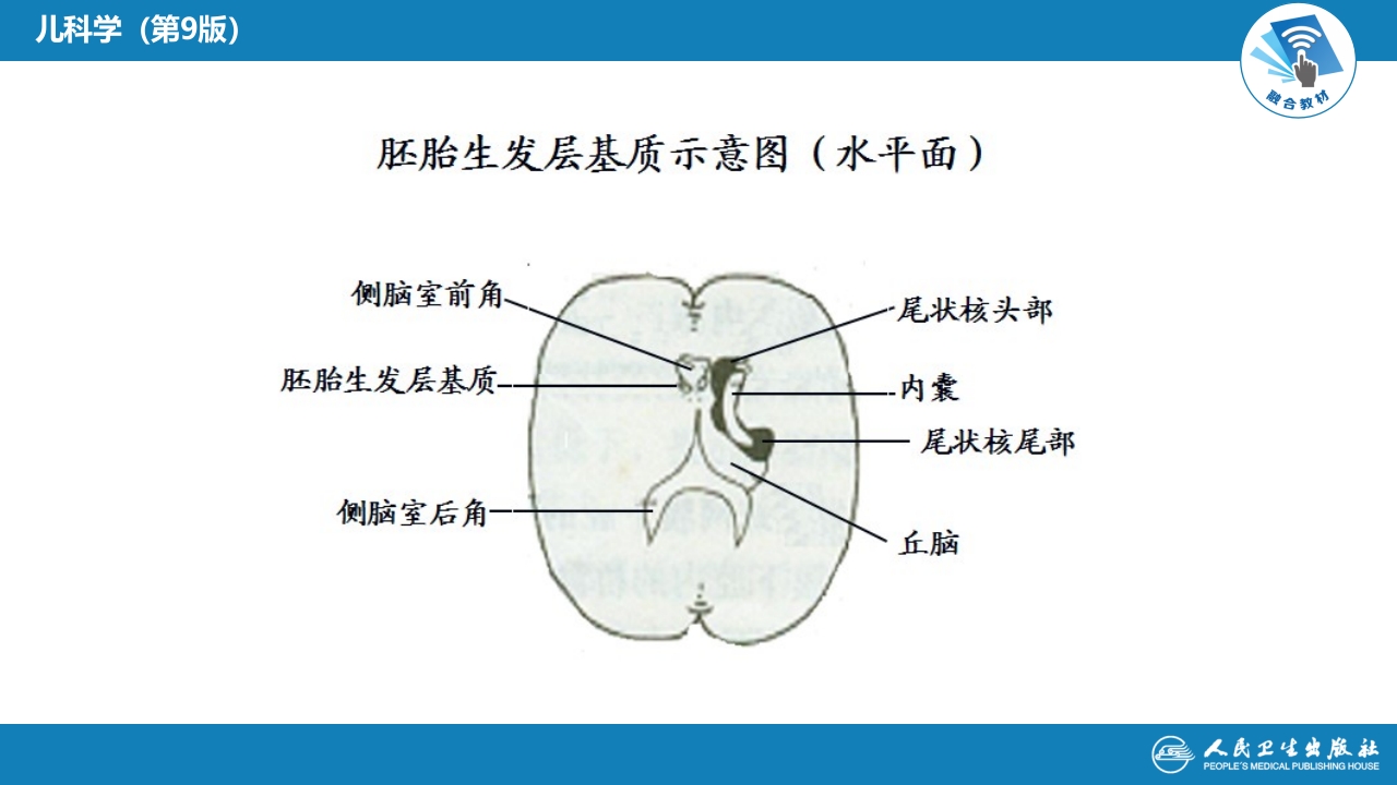 第六章 新生儿与新生儿疾病 第六节 新生儿颅内出血