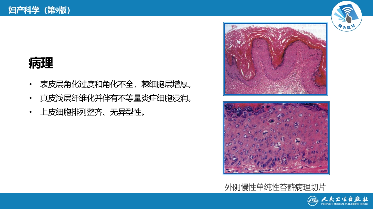 第十七章外阴色素减退性疾病.