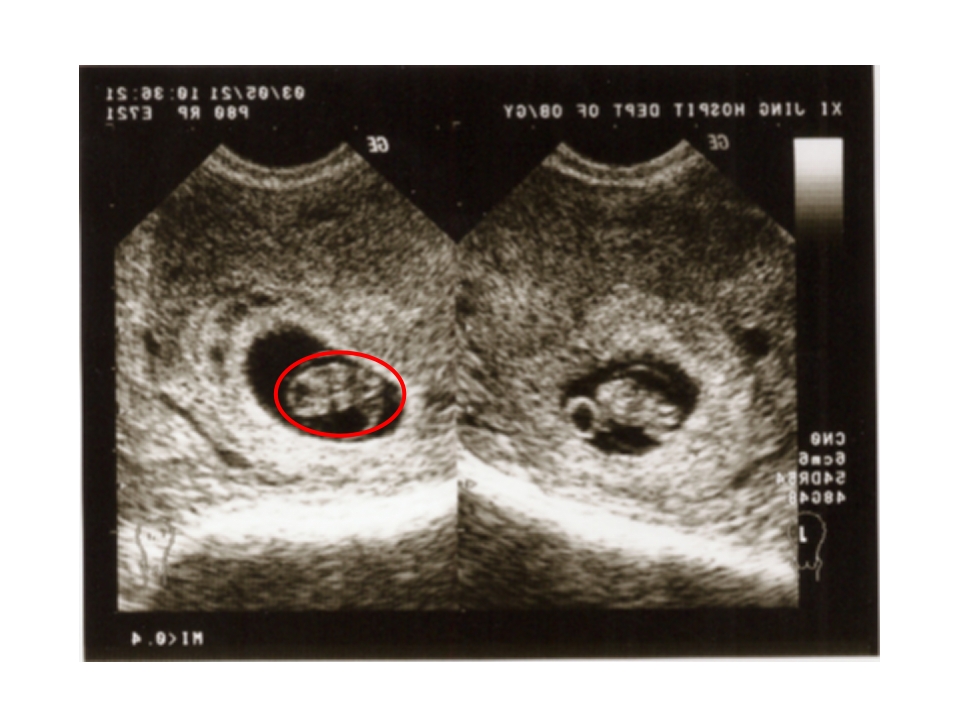 产科急救常识复件