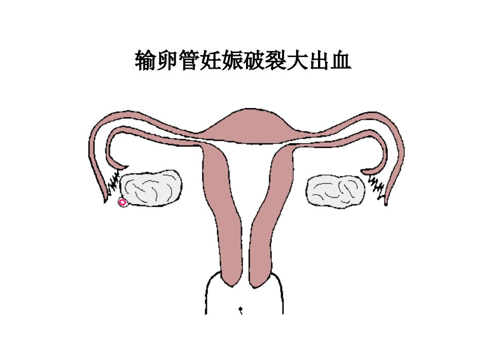 产科急救常识复件