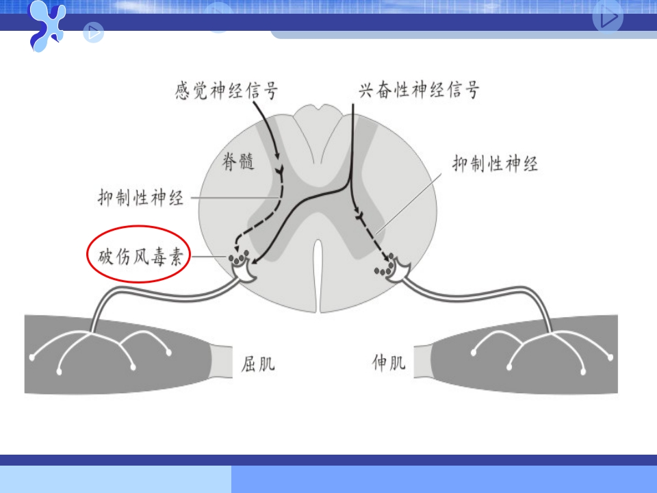 破伤风的临床分级及治疗