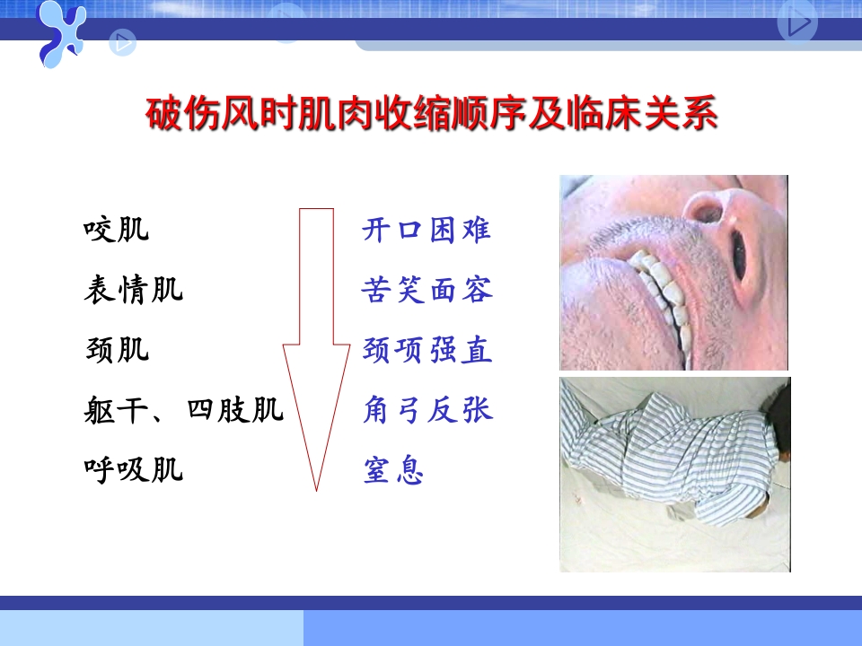 破伤风的临床分级及治疗