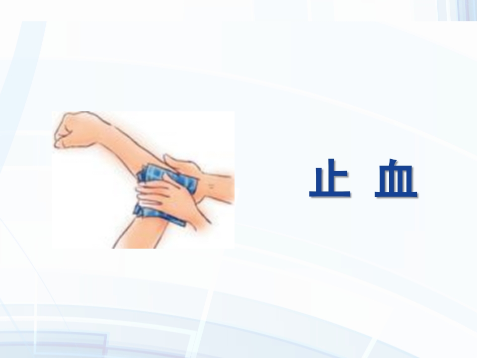 创伤的止血包扎固定搬运