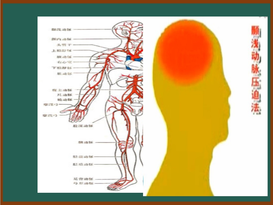 开放性伤口的止血包扎技术