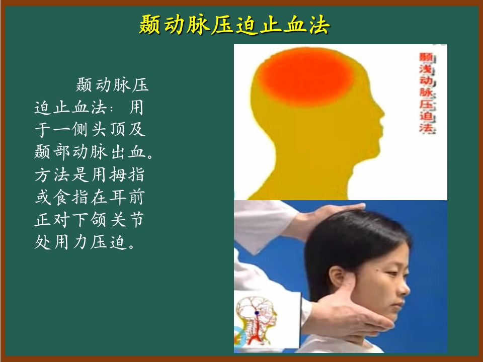 开放性伤口的止血包扎技术