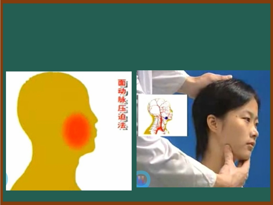 开放性伤口的止血包扎技术