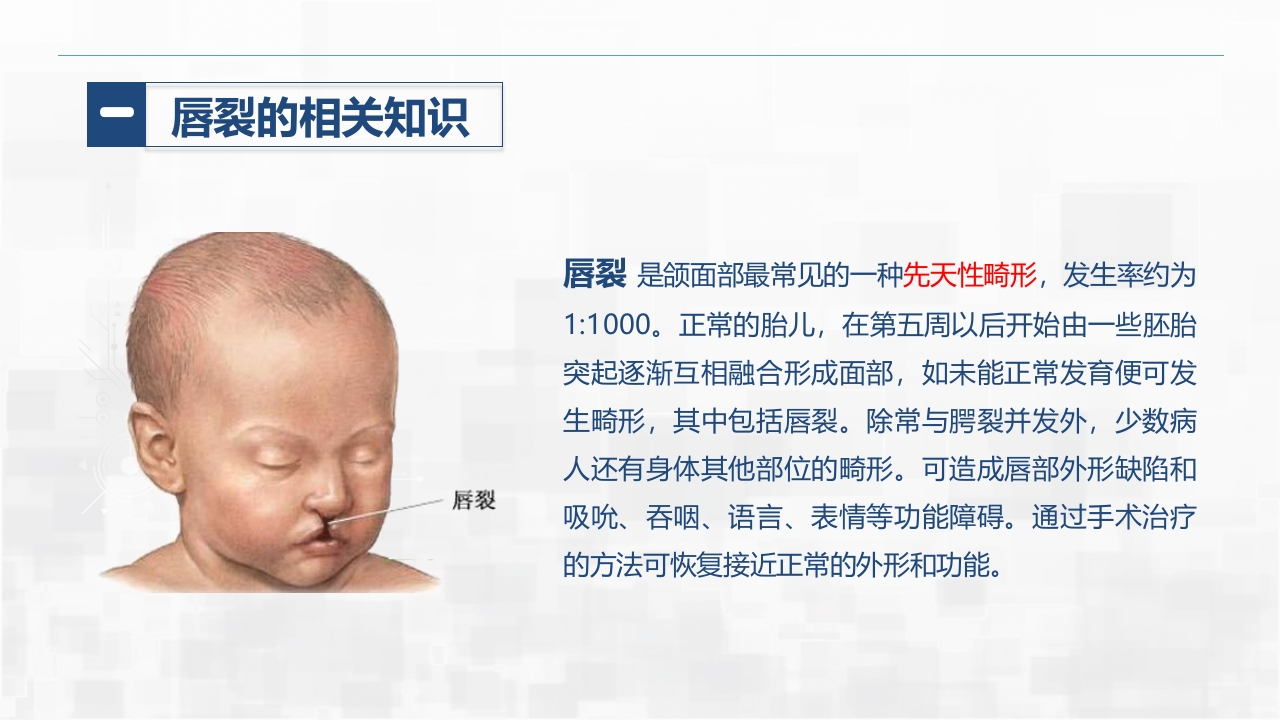 新生儿唇裂的护理+问题