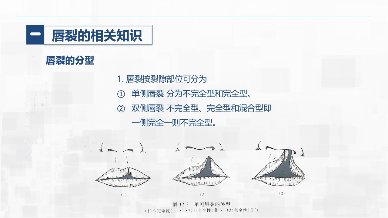 新生儿唇裂的护理+问题