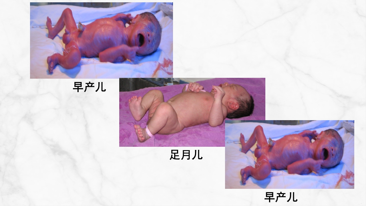 新生儿护理常规 (2)