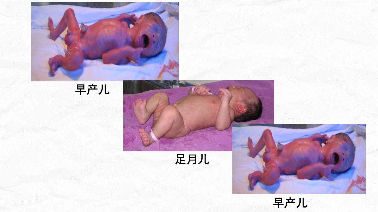 新生儿护理常规