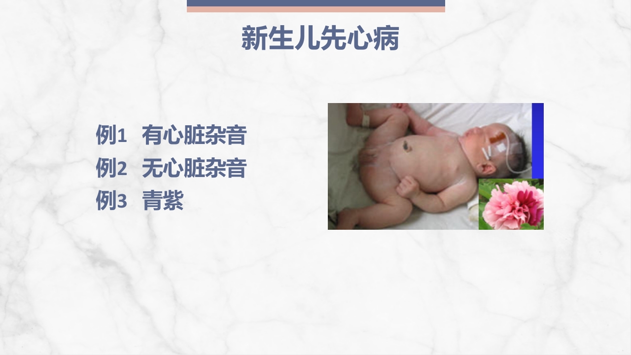 新生儿先天性心脏病病例讨论