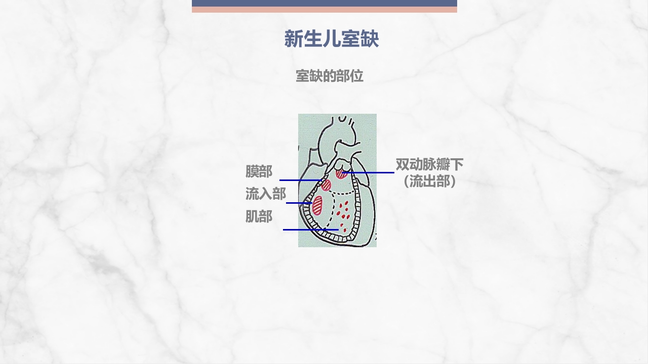 新生儿先天性心脏病病例讨论