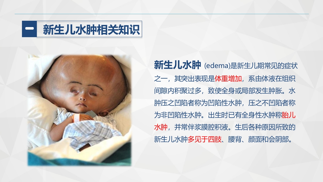 新生儿水肿的护理