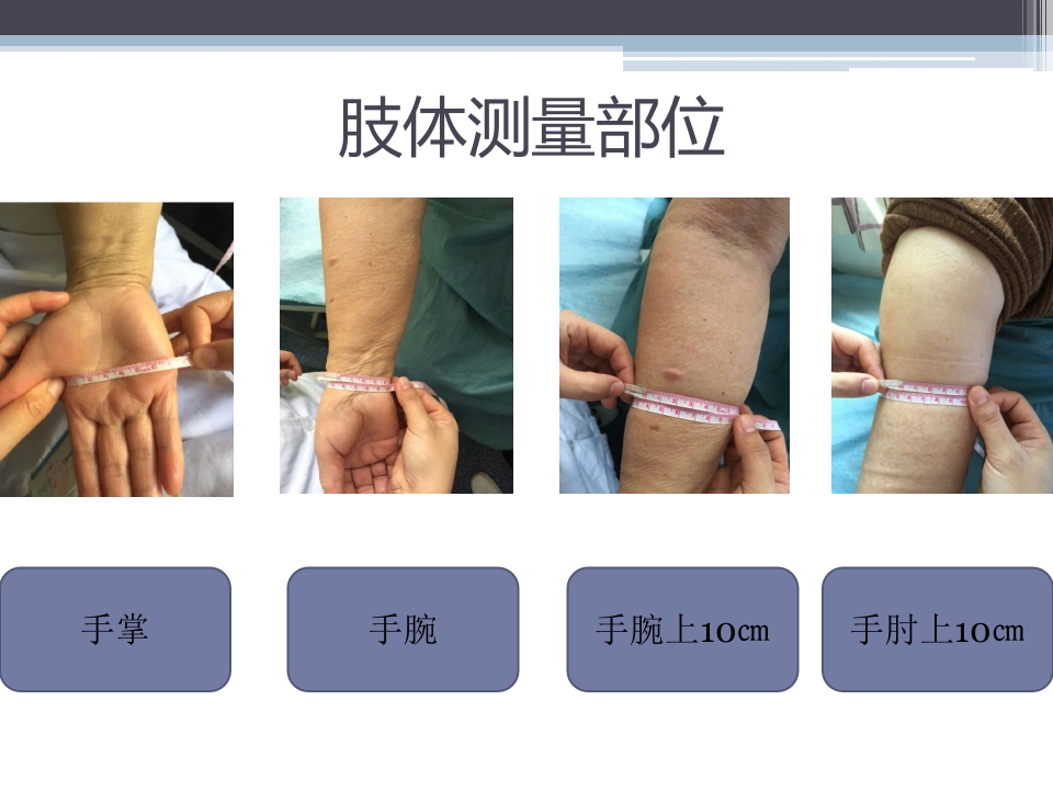 淋巴水肿的护理体会