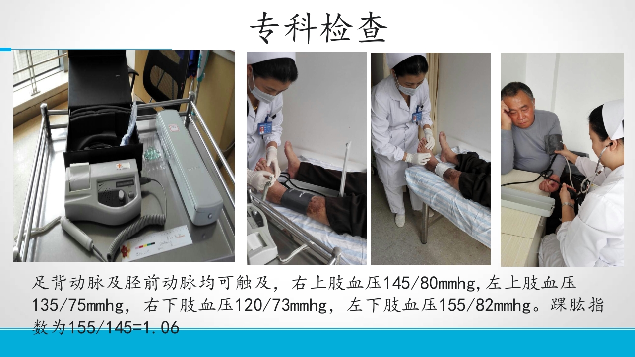 下肢静脉溃患者的护理