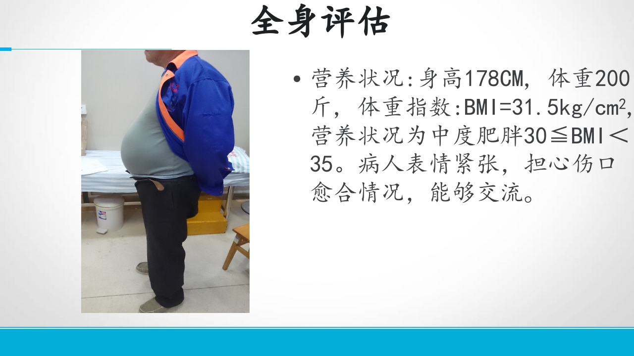 下肢静脉溃患者的护理