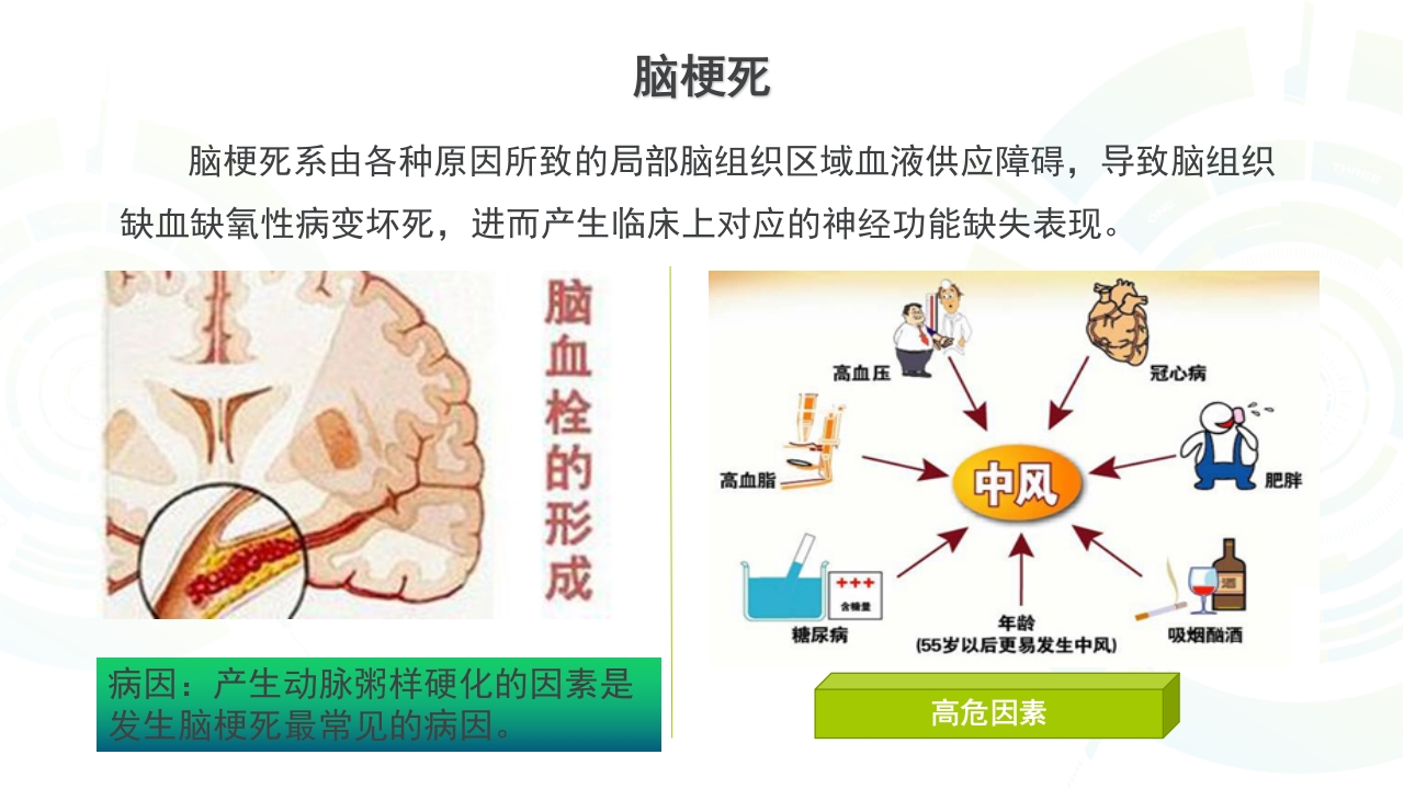一例多发性脑梗死患者康复护理A