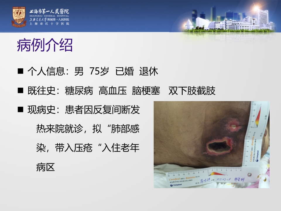 一例糖尿病合并骶尾部压疮患者的护理