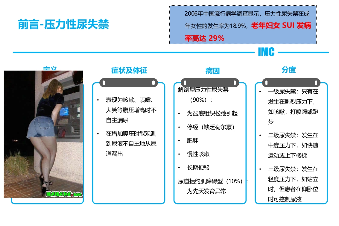 一例压力性尿失禁患者术后个案护理