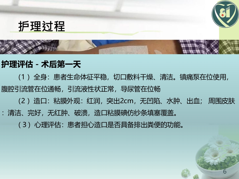 一例直肠癌术后造口护理