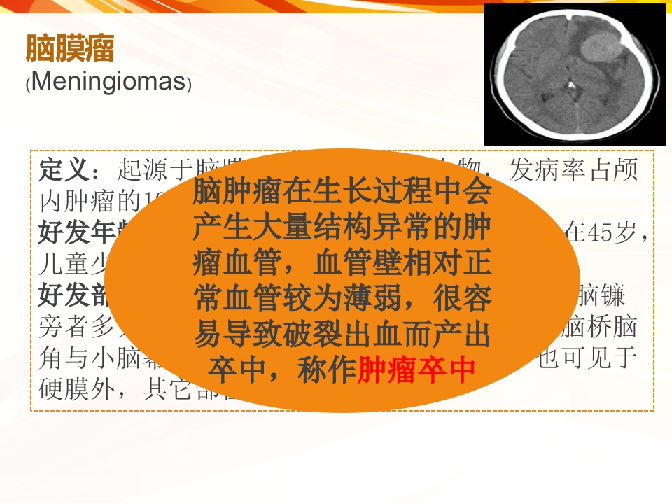 一例肿瘤卒中患者的护理