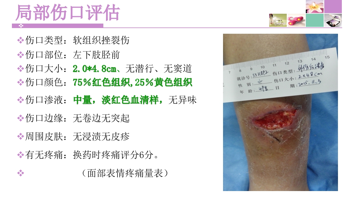 一例左下肢软组织挫裂伤患者护理