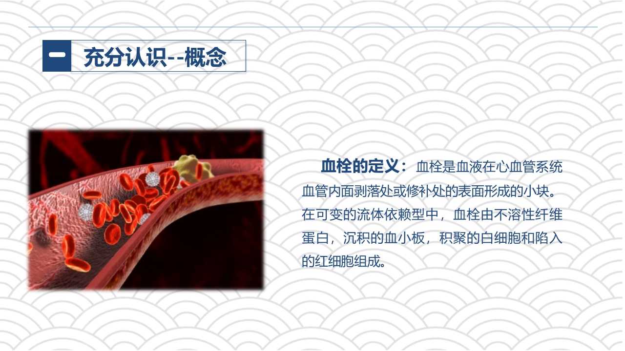 PICC相关静脉血栓护理的业务学习