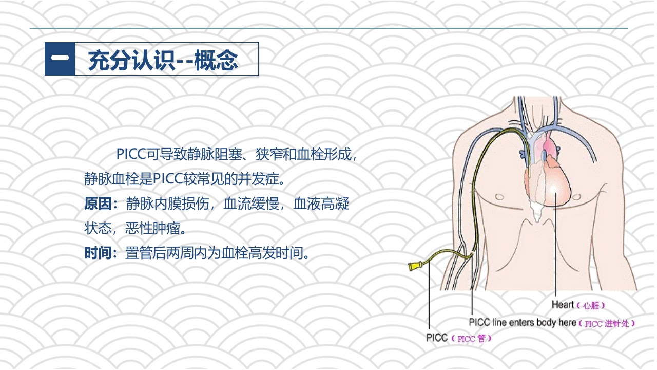 PICC相关静脉血栓护理的业务学习