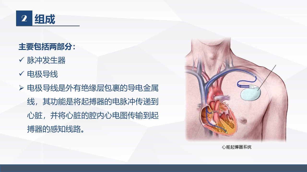 永久起搏器的业务学习