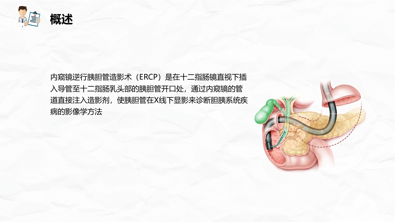ERCP护理业务课件