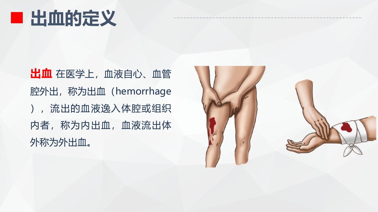 出血的观察和护理