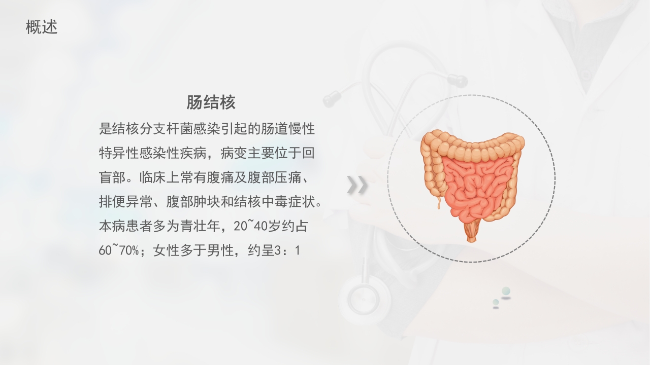肠结核护理查房-模板参考 (2)